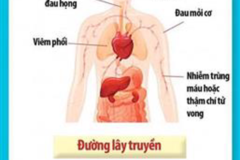 Các triệu chứng khi nhiễm vi rút Corona